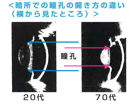 暗所での眼の断面図比較