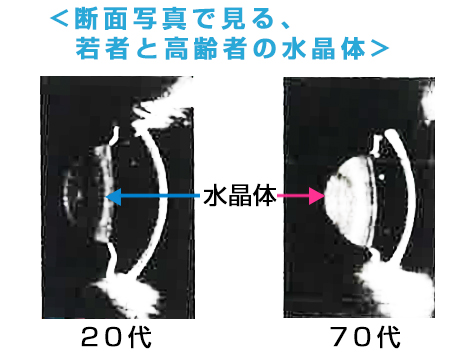 年代別水晶体の断面図比較